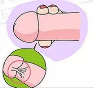 早泄捏挤法